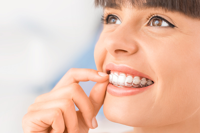 Orthodontics in Kent