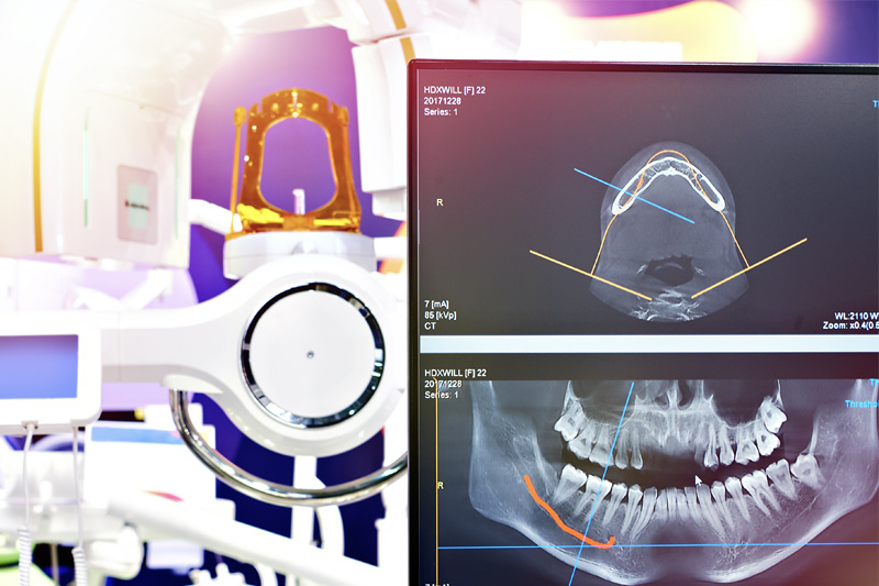 Digital X-Rays in Kent