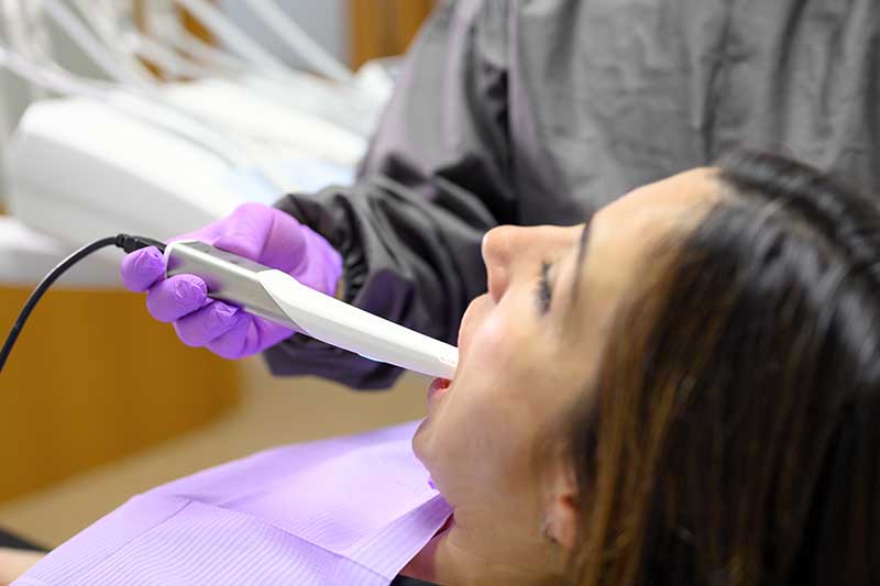 Intra-Oral Camera in Kent